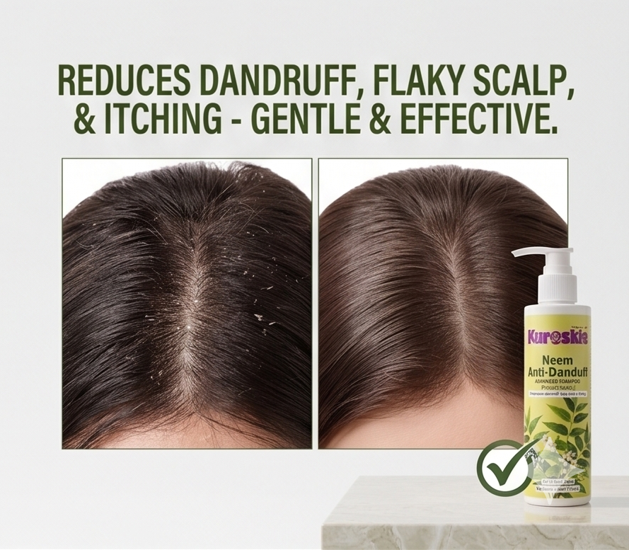 Neem Anti-Dandruff Shampoo With Pump Dispenser