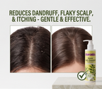Neem Anti-Dandruff Shampoo With Pump Dispenser