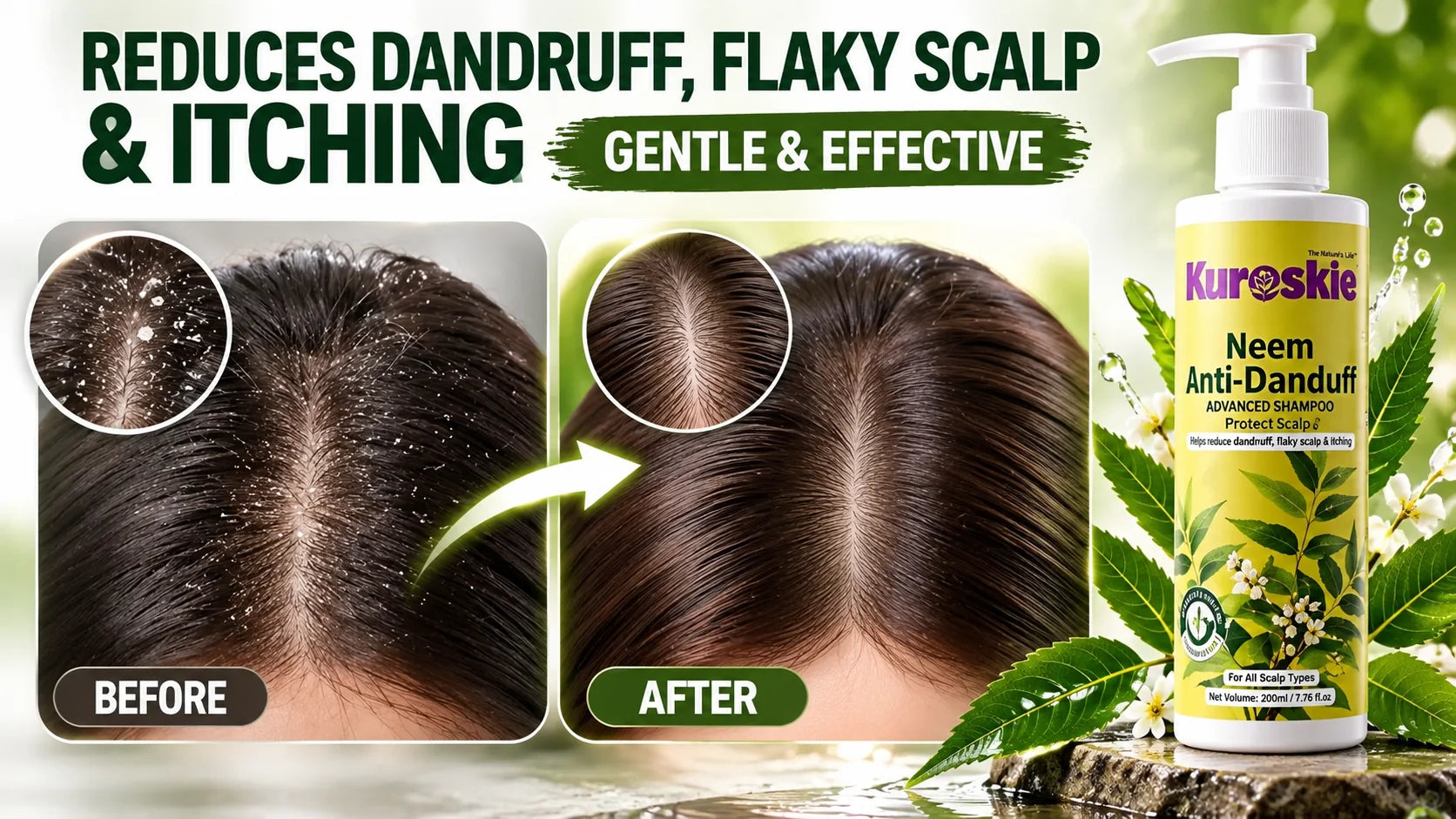 Neem Anti-Dandruff Shampoo With Pump Dispenser - brand image 3